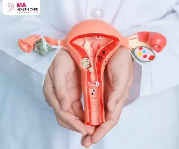Nursing Care Plan for Cervical Cancer Nursing Care Plan for Cervical Cancer